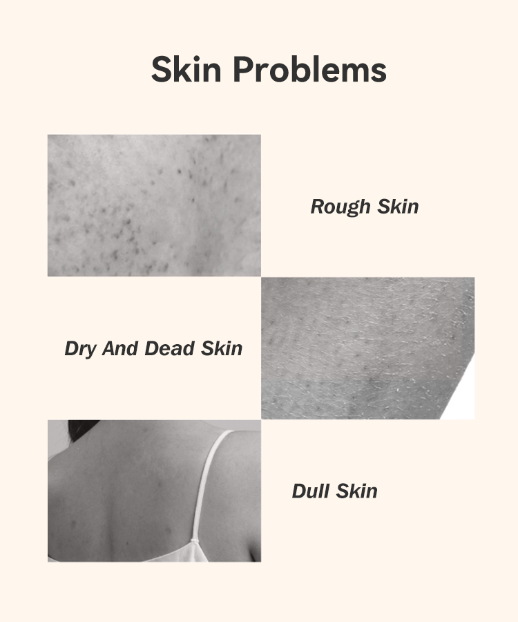 Perfect Care Turmeric Body Scrub Body Exfoliant Hyperpigmentation for Dark Spots