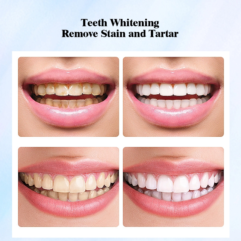 Teeth Whitening Powder- Natural Teeth Whitening, Teeth Polish & Teeth Stain Remover