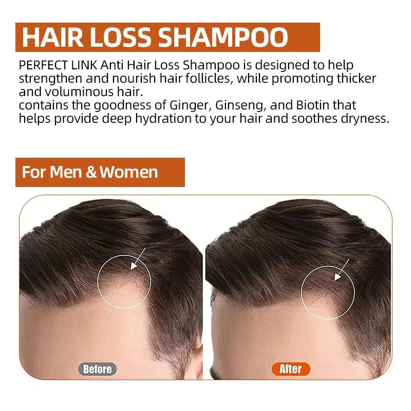 Anti-Hair Loss Shampoo with Natural Herbal Essence-Perfectlink