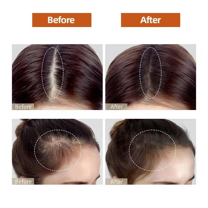 Anti-Hair Loss Shampoo with Natural Herbal Essence-Perfectlink Anti-Hair Loss Shampoo with Natural Herbal Essence-Perfectlink