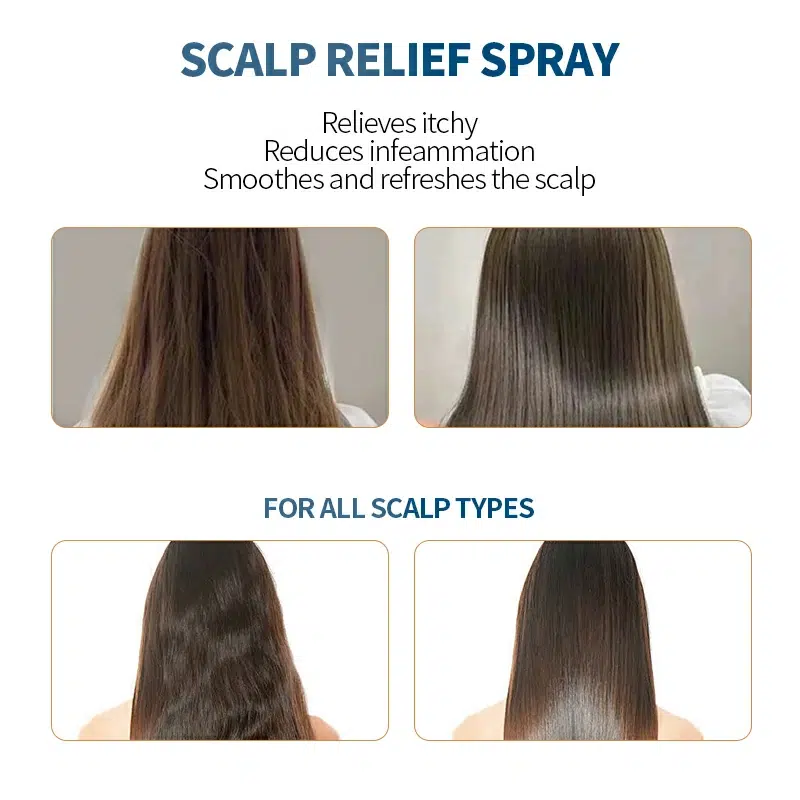 Itchy Scalp Relief Spray Wholesale & Private Labeling Itchy Scalp Relief Spray Wholesale & Private Labeling