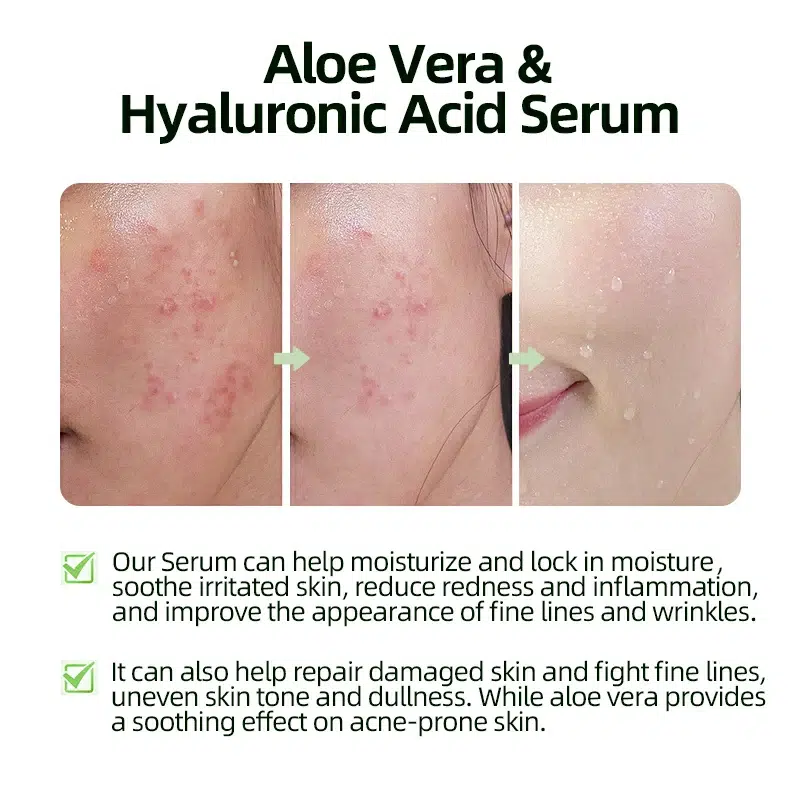 Aloe Vera Serum With Hyaluronic Acid Private Label-gzperfectlink
