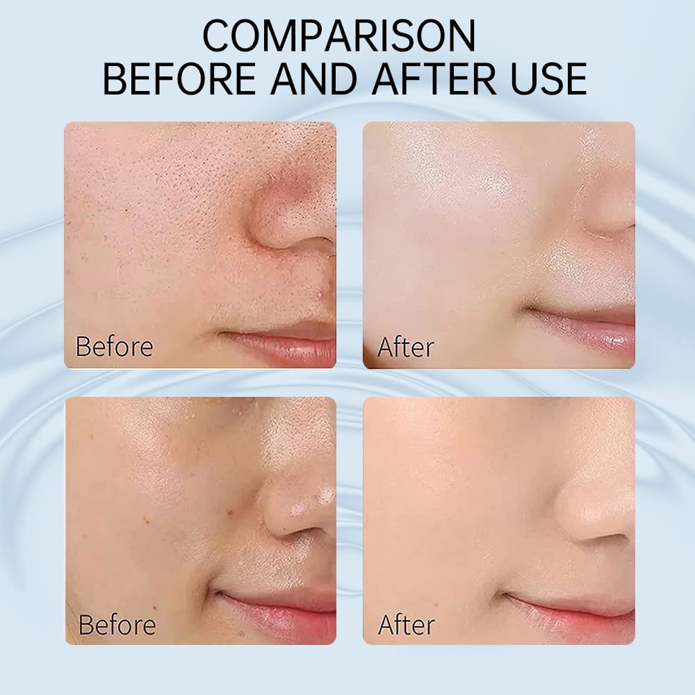 5 Pore Minimizer Serum, Facial Essence for Shrinking Pores