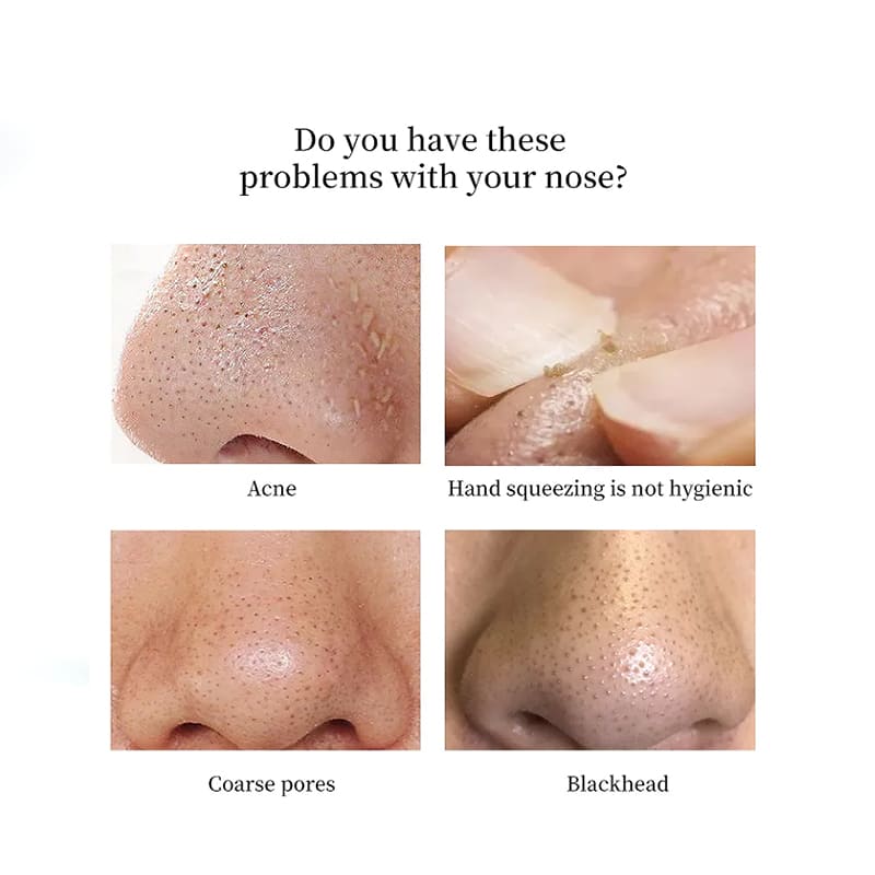 Deep Blackhead Removal-Removing Kit with Tea Tree Oil Deep Blackhead Removal-Removing Kit with Tea Tree Oil