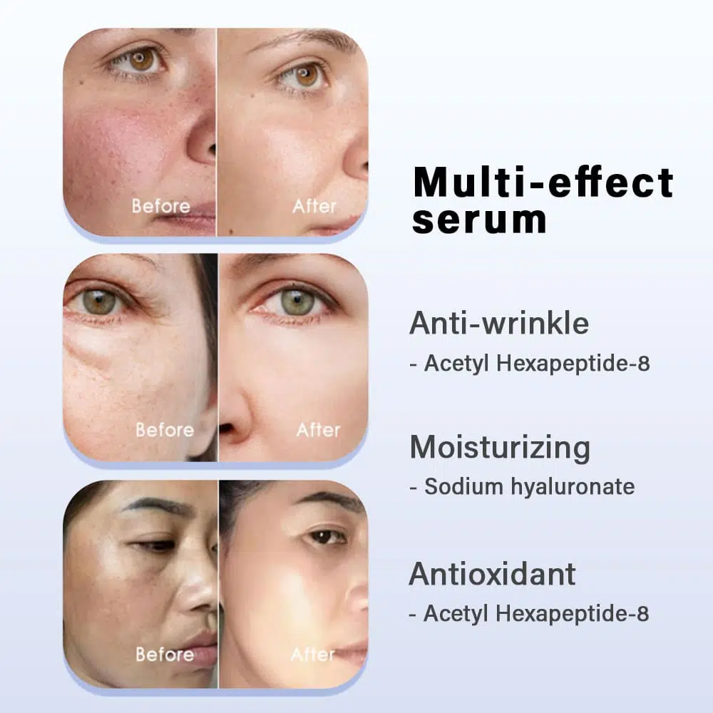 Hyaluronic Serum- Improves Skin Elasticity-Gzperfectlink Hyaluronic Serum- Improves Skin Elasticity-Gzperfectlink