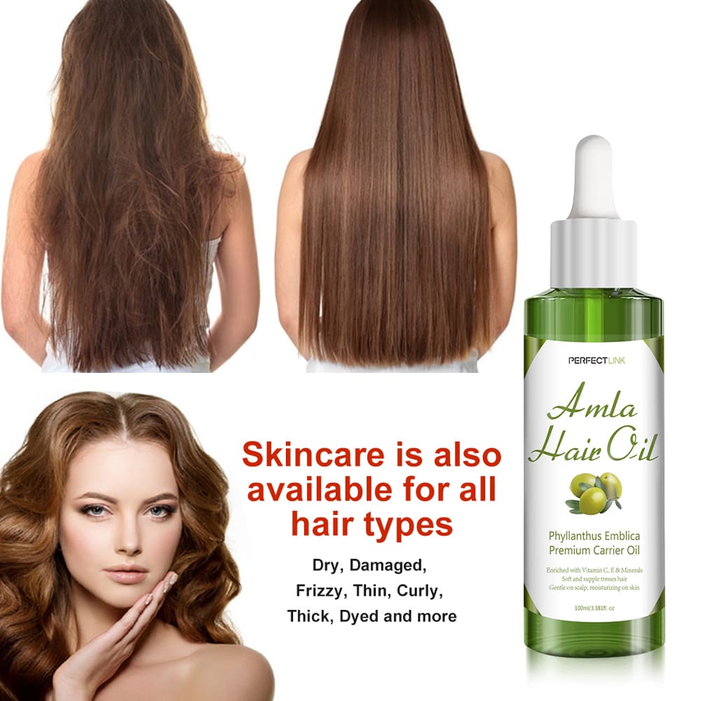 Amla Hair Oil For Hair Care,Prevents Hair Loss-Gzperfectlink Amla Hair Oil For Hair Care,Prevents Hair Loss-Gzperfectlink