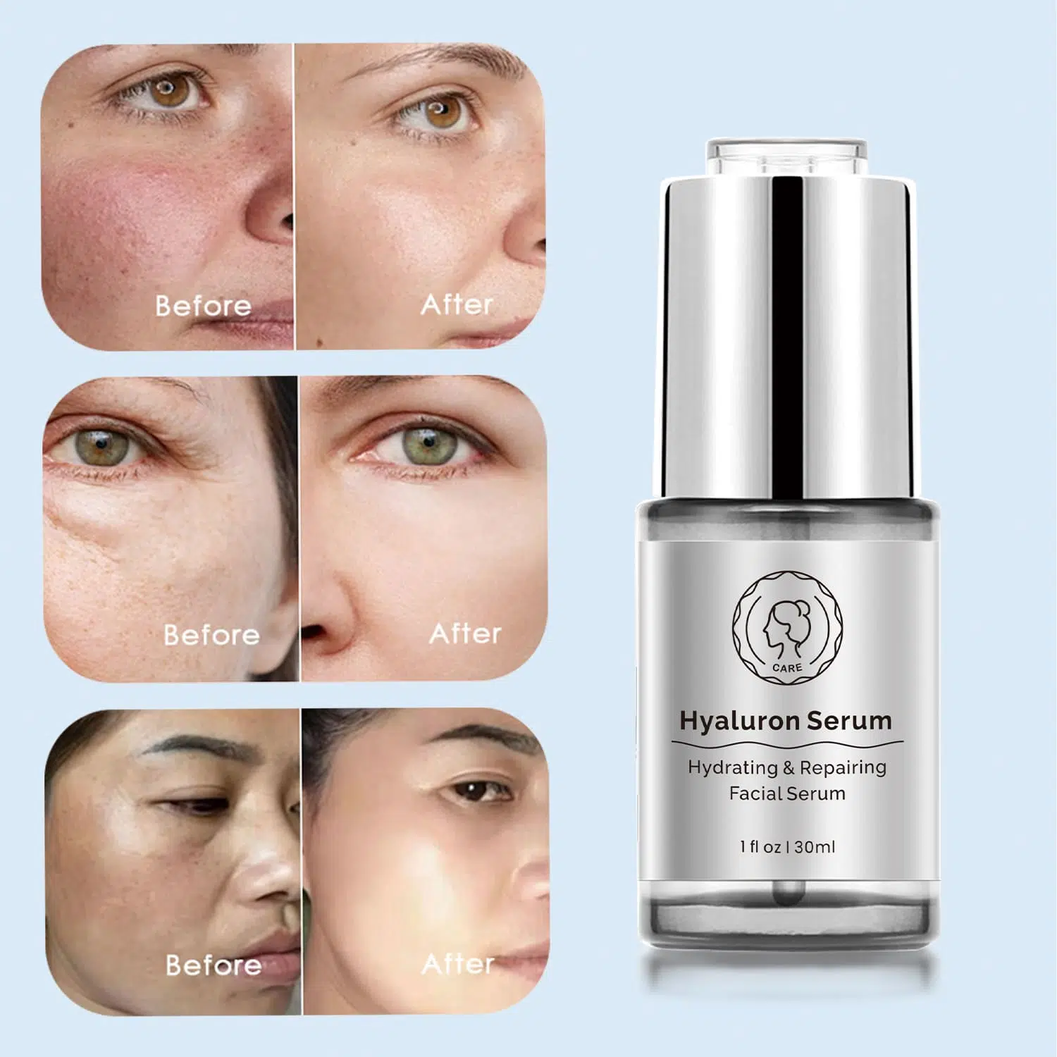 Hyaluron Serum Skin Care,Private Label Cosmetics-Gzperfectlink Hyaluron Serum Skin Care,Private Label Cosmetics-Gzperfectlink
