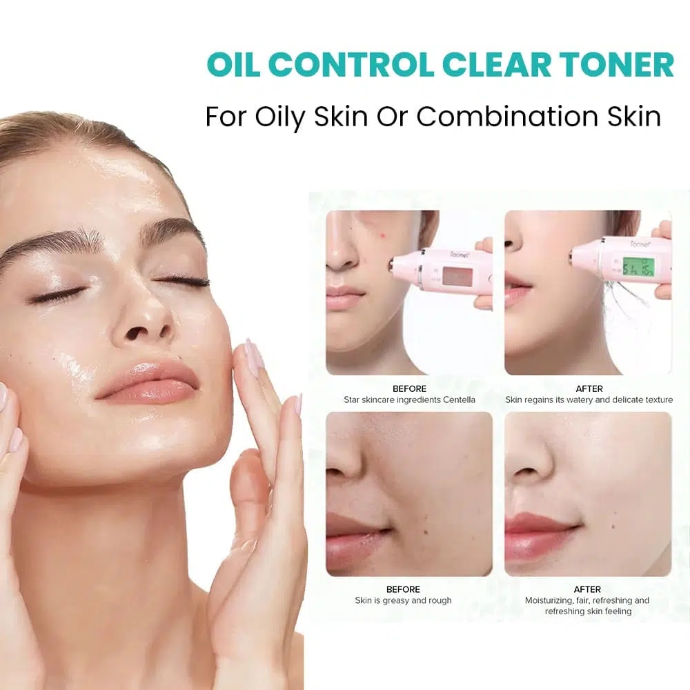 Oil Control Toner,Skincare Product Manufacturer-Gzperfectlink Oil Control Toner,Skincare Product Manufacturer-Gzperfectlink