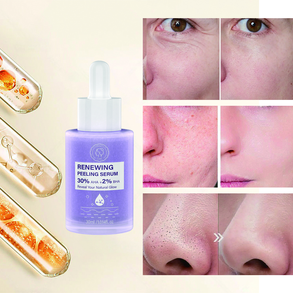 9 Peeling Serum 30%AHA+2%BHA,Private Label Skincare Products