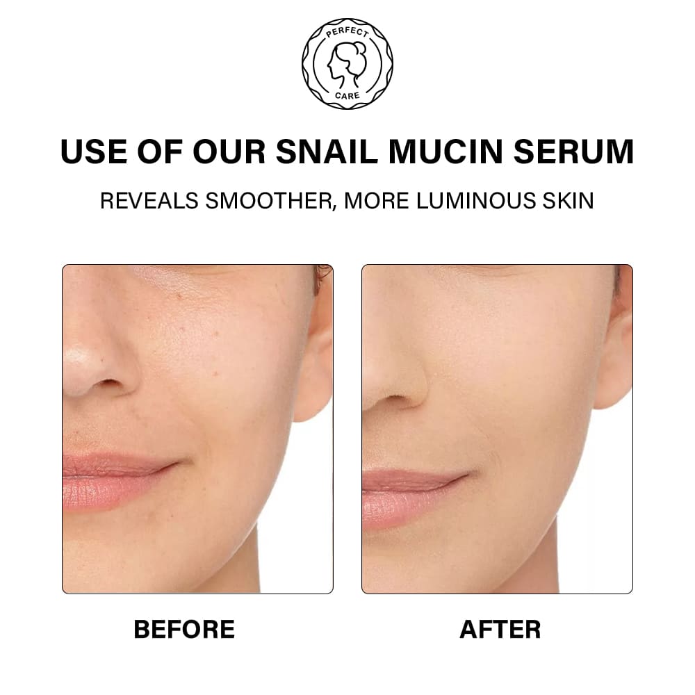 蜗牛精华_0009_10 Snail Mucin Radiance Essence,OEM Skincare Manufacturer
