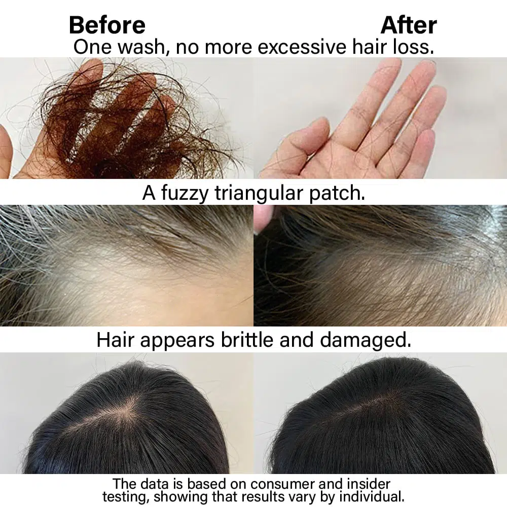 Perfectlink Scalp Revive Serum before and after use picture of Perfectlink Scalp Revive Serum
