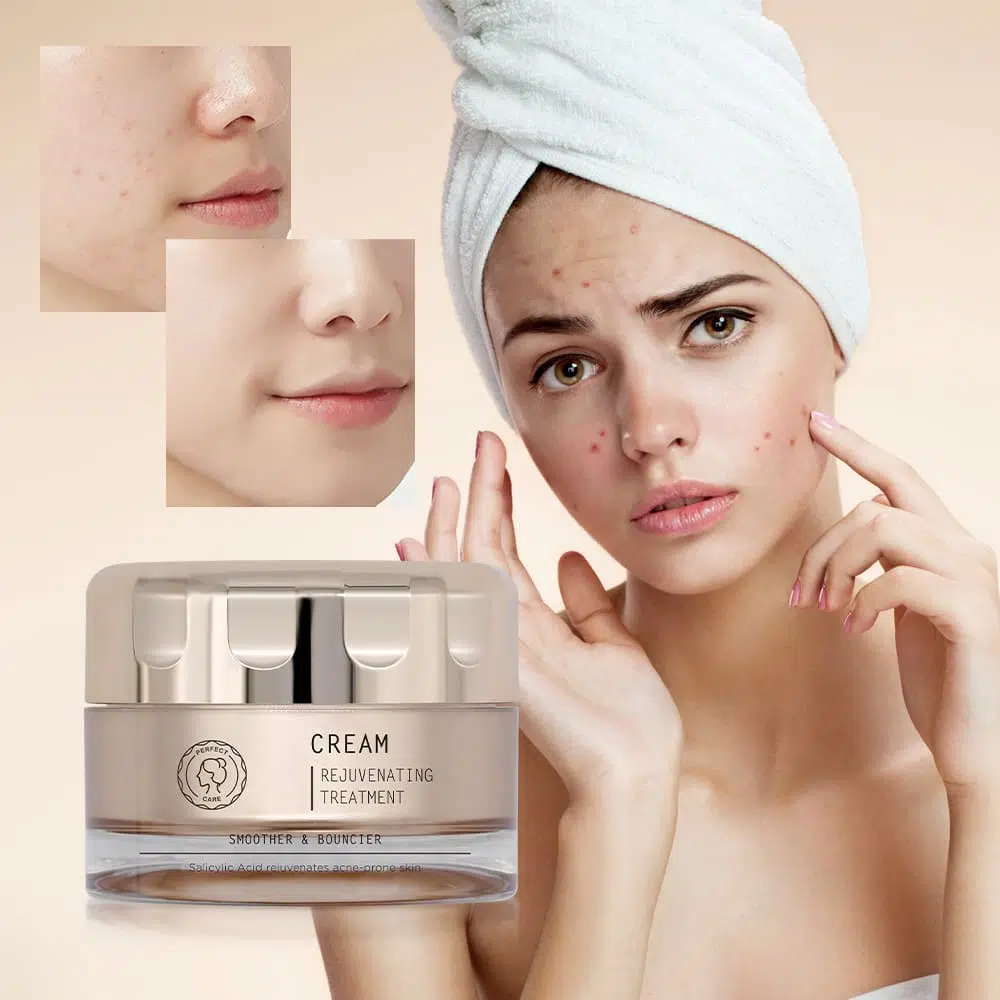 4Salicylic Acid Acne Cream,Facial Care Private Label In China Salicylic Acid Acne Cream,Facial Care Private Label In China