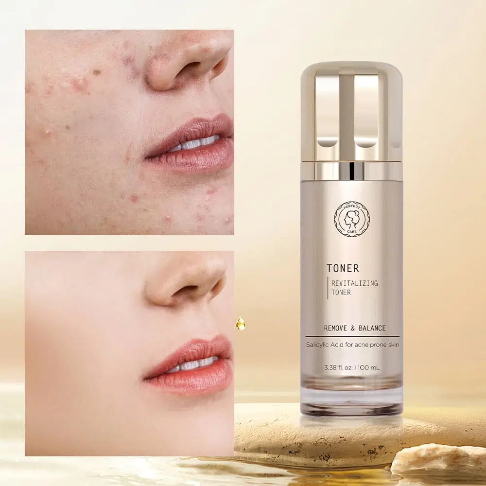 Salicylic Acid Acne Toner,Skincare Facial Toner Private Label Salicylic Acid Acne Toner,Skincare Facial Toner Private Label