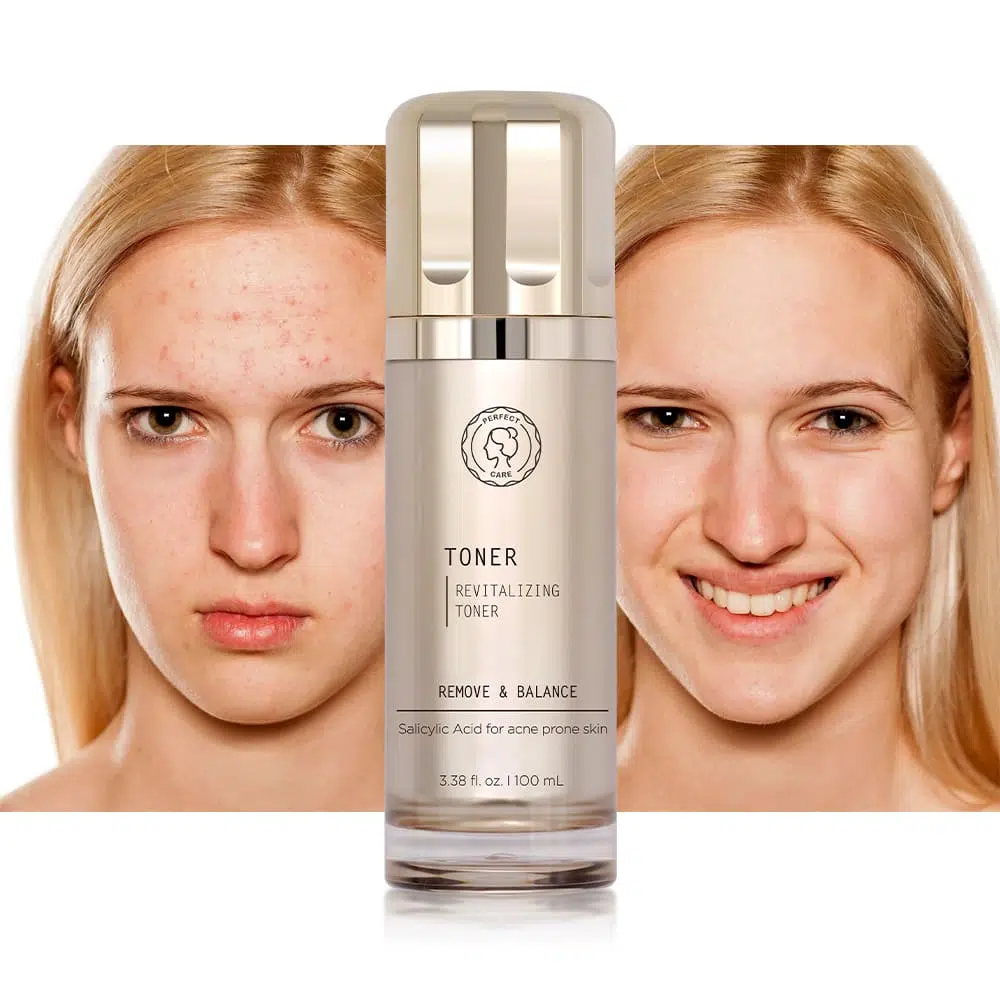 Salicylic Acid Acne Toner,Skincare Facial Toner Private Label Salicylic Acid Acne Toner,Skincare Facial Toner Private Label