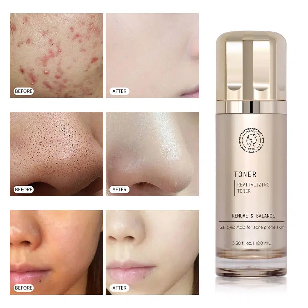 Salicylic Acid Acne Toner,Skincare Facial Toner Private Label Salicylic Acid Acne Toner,Skincare Facial Toner Private Label