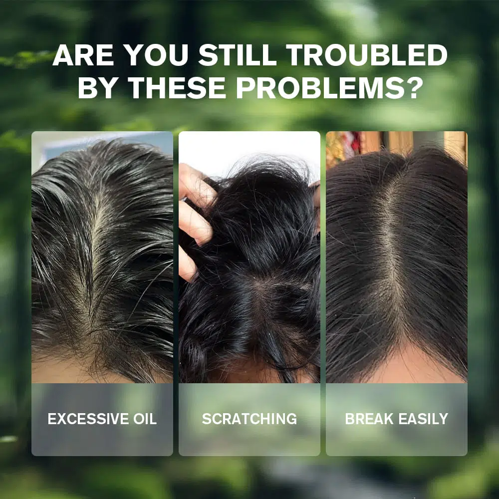 Advanced Scalp Tonic,Hair Scalp Care Private Label Advanced Scalp Tonic,Hair Scalp Care Private Label