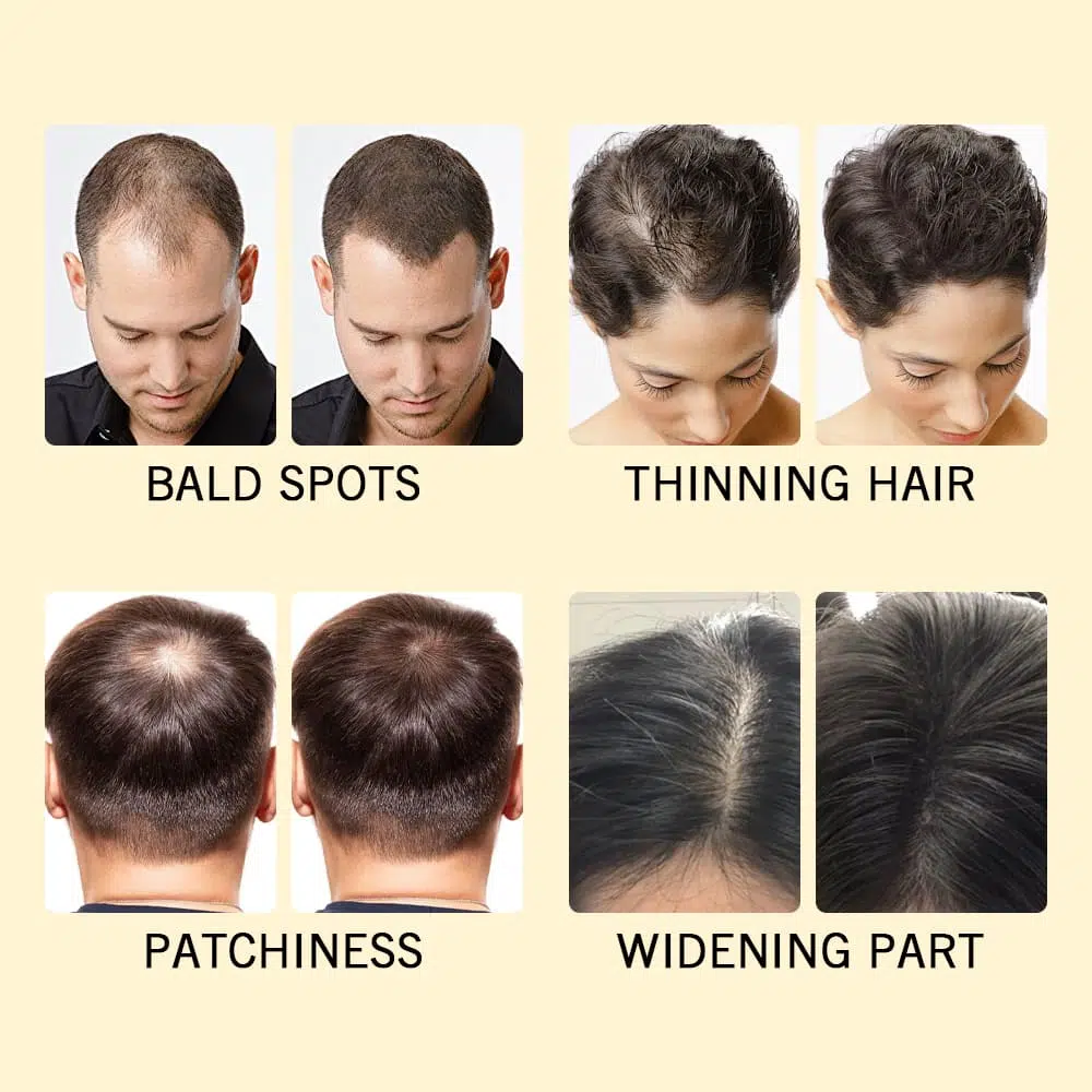 Hair Building Fiber Powder, Hair Growth Products Private Label Hair Building Fiber Powder, Hair Growth Products Private Label