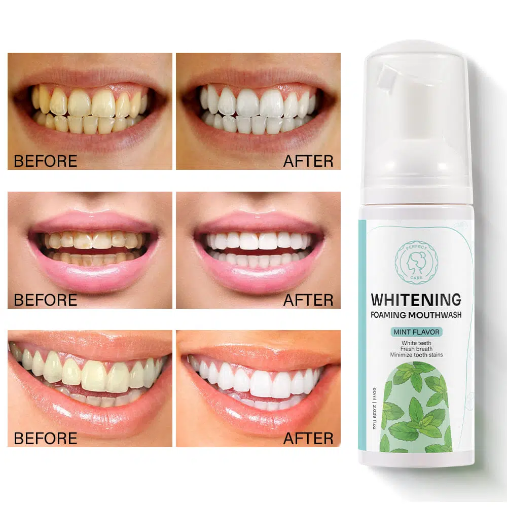 Whitening Mouthwash with Mint | Bodycare Products Private Label Whitening Mouthwash with Mint | Bodycare Products Private Label
