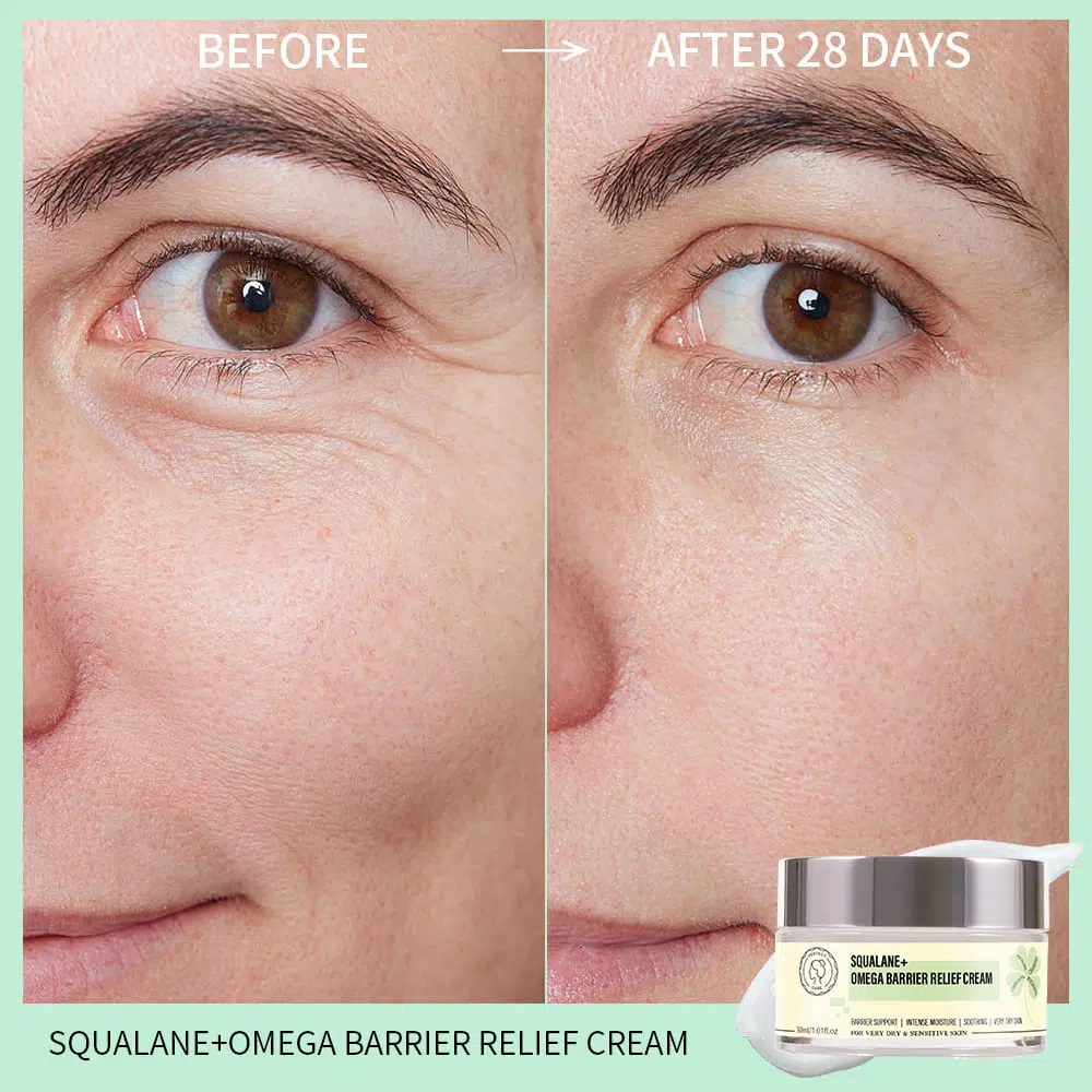 Squalane+ Omega Barrier Relief Cream, OEM Skincare Supplier usage display of Squalane+ Omega Barrier Relief Cream, OEM Skincare Supplier